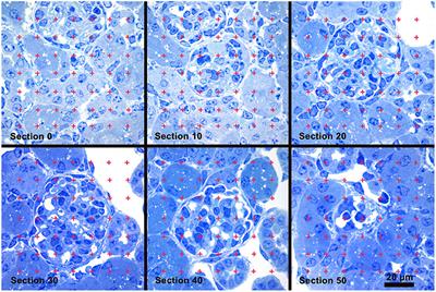 Podocyte Foot Process Effacement Precedes Albuminuria and Glomerular Hypertrophy in CD2-Associated Protein Deficient Mice